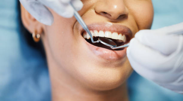 Best Emergency Dental Care for Abscessed Tooth in Vonore, TN